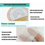 10x Bolsa Colostomía Drenable Con Filtro Anti Olor Y Gases Beige